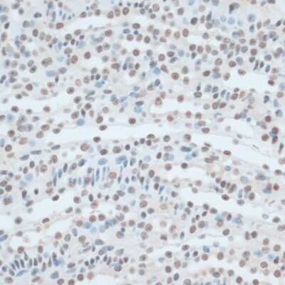 Immunohistochemistry-Paraffin: ZNF433 Antibody [NBP3-05110] - Immunohistochemistry of paraffin-embedded mouse kidney using ZNF433 antibody (NBP3-05110) at dilution of 1:100 (40x lens). Perform microwave antigen retrieval with 10 mM PBS buffer pH 7.2 before commencing with IHC staining protocol.